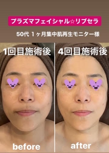 アンチエイジング リブセラ お試し